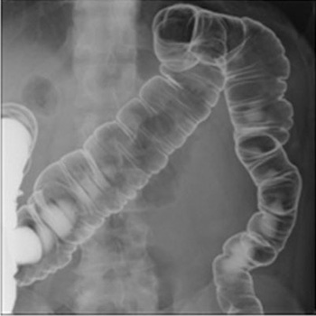 radiography_09