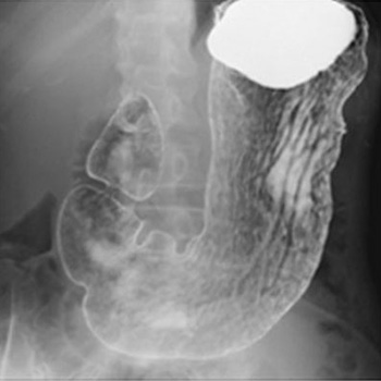 radiography_11
